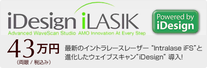 アイレーシック 43万円