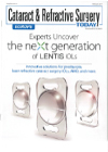 PERSONAL EXPERIENCE WITH THE LENTIS MPLUS X IOL
