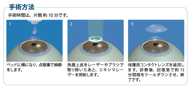 ”手術方法”