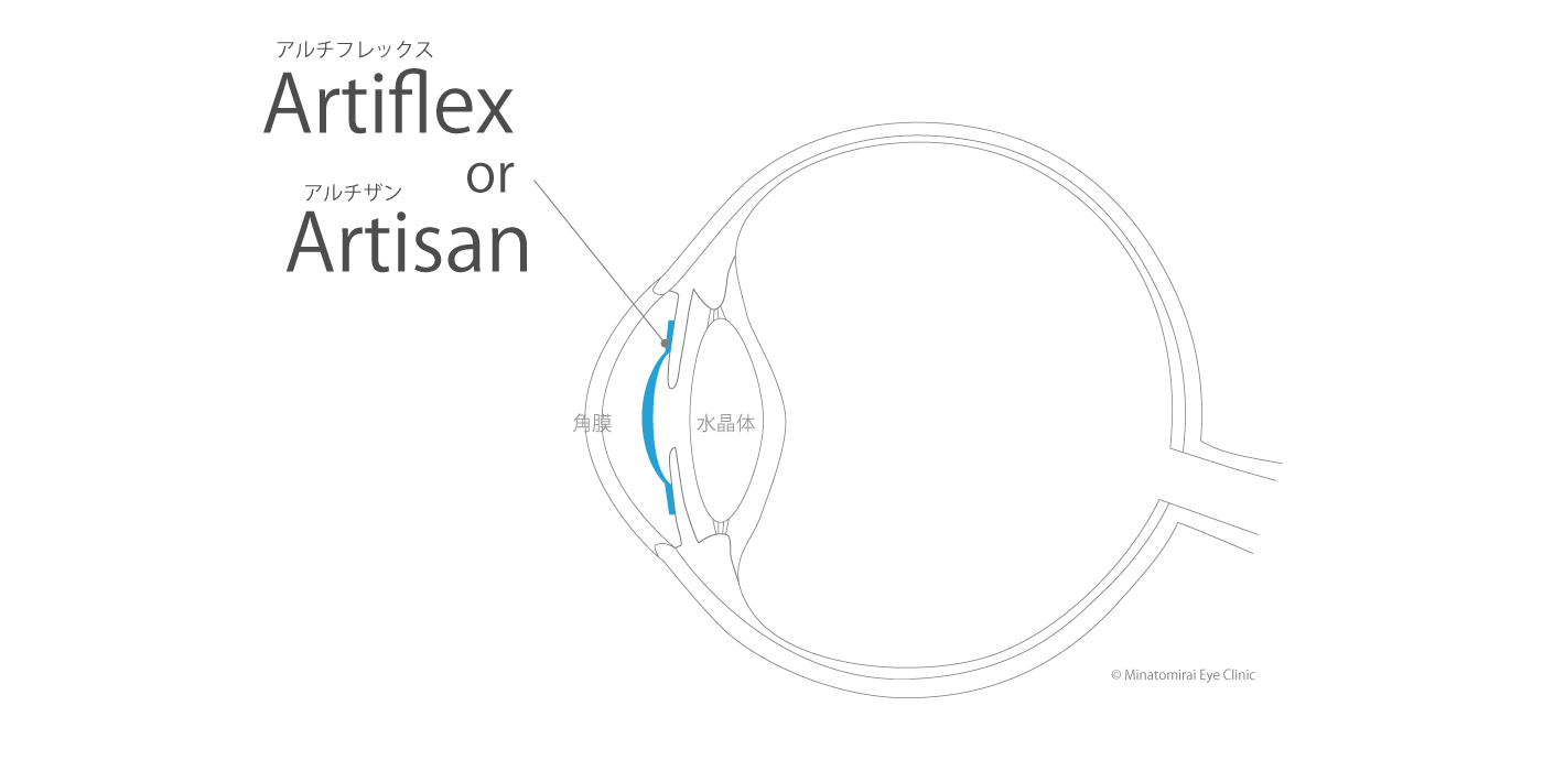 断面図